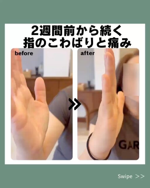 【指のこわばり  before→after】

40代／女性

2週間前から右の薬指にこわばりが出はじめ、
指を伸ばすとロックがかかるような痛みが続いていました。
さらに、首まわりにも動かしにくさを感じておられました。

本日の施術は、KYT（Ken Yamamotoテクニック）を用いた整体。
全身のバランスを整えながら、関節や筋肉がスムーズに動ける状態へ導いていきました。

施術後は、指や首の動きがスムーズになり、
「楽に動かせるようになった！」と驚きながらも笑顔でお話しくださいました🌿‬

体が整うと、動きは自然に変わっていきます。
今後も無理なく、自由に動ける身体を目指してサポートしていきます🦉

※施術効果には個人差があります

#ふくろう施術院#郡山#郡山整体#KYT#整体#鍼灸#美容鍼#腰痛#肩こり#猫背#ストレートネック#巻き肩