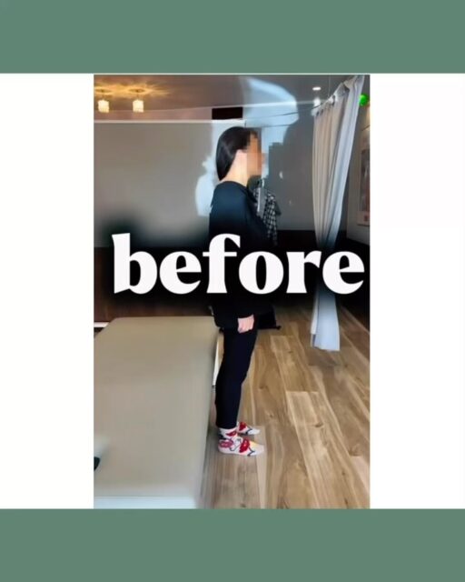 【動けないほどのギックリ腰Before → After】

40代 / 女性

耕運機を移動させた瞬間、強い痛みが走り
そのまま動けなくなってしまったとのこと。

来院時は、ベッドに横になるだけでもつらい状態。
寝返りや体勢の変化でも痛みが出てしまうほどでした。

施術は KXT・KYT を用いて全身を調整。

まずKXTで数ヶ所アプローチすると…

「寝ているのが楽になった」
「動かされても痛くない」

と、早い段階で変化を感じていただけました。

残る痛みや動きの硬さはKYTで整え、
立ち上がって動作確認をすると――

施術前との違いに 思わず笑ってしまうほどの変化。
スムーズに動ける状態まで回復しました✨

施術後の状態👇
✔ こどもを抱っこしてもOK
✔ 小走りOK
✔ 日常動作で痛みなし

「動けるって嬉しいですね」
そう言って笑顔でお帰りになりました🦉

ギックリ腰は、放置すると再発しやすい症状。
無理をせず、早めのケアをおすすめします。

―――――――――
※施術効果には個人差があります
―――――――――

#郡山#整体#KYT