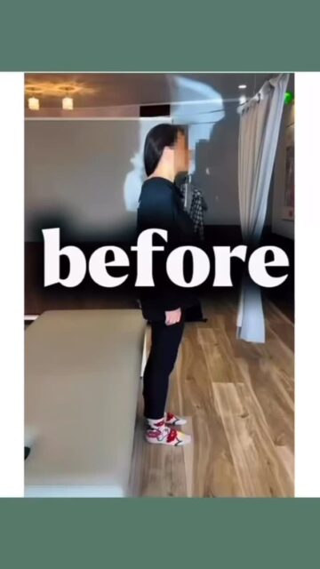 【動けないほどのギックリ腰Before → After】

40代 / 女性

耕運機を移動させた瞬間、強い痛みが走り
そのまま動けなくなってしまったとのこと。

来院時は、ベッドに横になるだけでもつらい状態。
寝返りや体勢の変化でも痛みが出てしまうほどでした。

施術は KXT・KYT を用いて全身を調整。

まずKXTで数ヶ所アプローチすると…

「寝ているのが楽になった」
「動かされても痛くない」

と、早い段階で変化を感じていただけました。

残る痛みや動きの硬さはKYTで整え、
立ち上がって動作確認をすると――

施術前との違いに 思わず笑ってしまうほどの変化。
スムーズに動ける状態まで回復しました✨

施術後の状態👇
✔ こどもを抱っこしてもOK
✔ 小走りOK
✔ 日常動作で痛みなし

「動けるって嬉しいですね」
そう言って笑顔でお帰りになりました🦉

ギックリ腰は、放置すると再発しやすい症状。
無理をせず、早めのケアをおすすめします。

―――――――――
※施術効果には個人差があります
―――――――――

#郡山#整体#腰痛