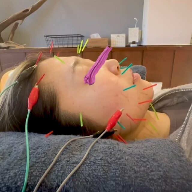 🦉
【鏡見て、ちょっと嬉しくなる変化】

鼻まわりがスッキリして、
フェイスラインもシャープな印象に✨

お顔全体のむくみが取れることで、
本来のスッキリした状態に近づきます。

実際に鏡を見た患者さんからも
「口角が上がってる！」
「顔の幅が小さくなった感じがする！」
と嬉しい変化を実感していただきました😊

なんとなく顔が重い、スッキリしない…
そんな方は一度リセットしてみませんか？

 #郡山 #美容鍼 #鍼灸 #整体 #腰痛